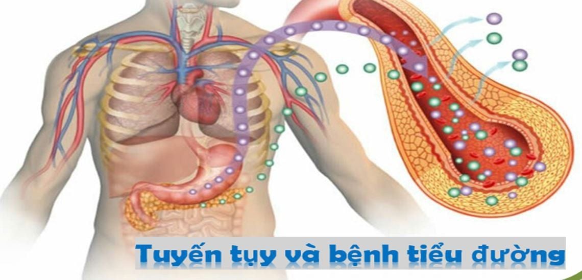 Bản chất của bệnh là do tuyến tụy bị tổn thương, thuốc Tây điều trị triệu chứng bệnh nhưng lại làm tổn thương thêm tuyến tụy! Sao lại như thế?